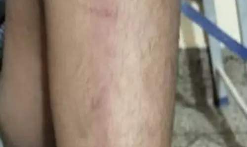 तखतपुर स्कूल में खेल शिक्षक ने बच्चों को पाइप से पीटा तखतपुर स्कूल में खेल शिक्षक ने बच्चों को पाइप से पीटा