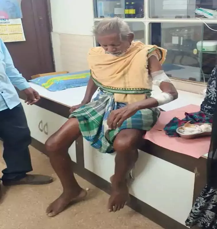Boar attack: जंगली सुअर के हमले में ग्रामीण घायल, वन विभाग सतर्क Boar attack: जंगली सुअर के हमले में ग्रामीण घायल, वन विभाग सतर्क
