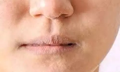 Skin Care: सर्दियों में बार-बार रूखी हो रही त्वचा, घरेलू नुस्खे देंगे राहत Skin Care: सर्दियों में बार-बार रूखी हो रही त्वचा, घरेलू नुस्खे देंगे राहत