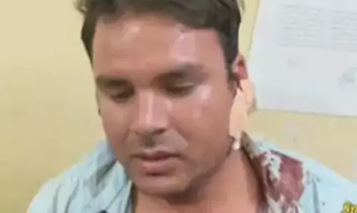 एंबुलेंस चालकों की पिकनिक पार्टी में चला चाकू, एक की हालत नाजुक