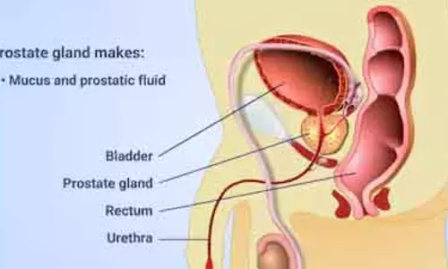 प्रोस्टेट Cancerके बारे में जरूरी जानकारी