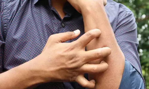 ड्राई या खुजली वाली Skin से किडनी भी हो सकती है प्रभावित ड्राई या खुजली वाली Skin से किडनी भी हो सकती है प्रभावित