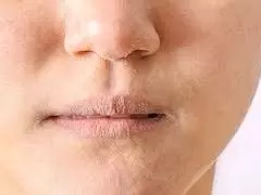 Skin Care: सर्दियों में बार-बार रूखी हो रही त्वचा, घरेलू नुस्खे देंगे राहत Skin Care: सर्दियों में बार-बार रूखी हो रही त्वचा, घरेलू नुस्खे देंगे राहत