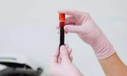 Science : सिर्फ 3 लोगों में मिला दुनिया का सबसे अनोखा ब्लड ग्रुप, थाईलैंड के वैज्ञानिकों की बड़ी खोज Science : सिर्फ 3 लोगों में मिला दुनिया का सबसे अनोखा ब्लड ग्रुप, थाईलैंड के वैज्ञानिकों की बड़ी खोज