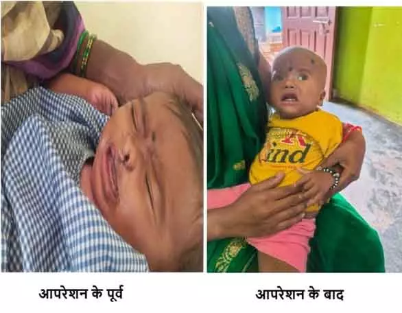 चिरायु योजना बच्चों के लिए भी बनी वरदान चिरायु योजना बच्चों के लिए भी बनी वरदान
