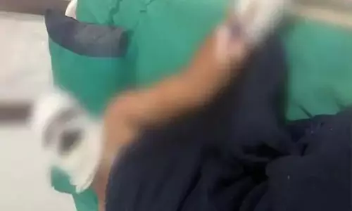 फ्लैक्स लगाने के दौरान बड़ी घटना, हाईटेंशन तार से झुलसे दो युवक