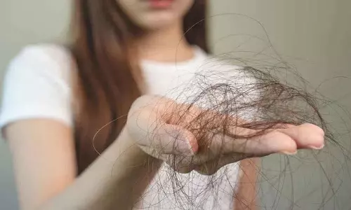 Hair Fall के कारण, यह समस्या क्यों होती है और इससे छुटकारा पाने के लिए क्या करें Hair Fall के कारण, यह समस्या क्यों होती है और इससे छुटकारा पाने के लिए क्या करें