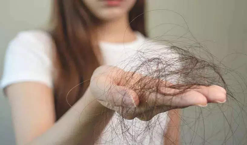 Hair Fall के कारण, यह समस्या क्यों होती है और इससे छुटकारा पाने के लिए क्या करें Hair Fall के कारण, यह समस्या क्यों होती है और इससे छुटकारा पाने के लिए क्या करें