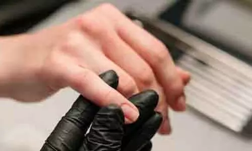 Hands और नाखून दे सकते हैं बीमारियों की शुरुआती चेतावनी Hands और नाखून दे सकते हैं बीमारियों की शुरुआती चेतावनी