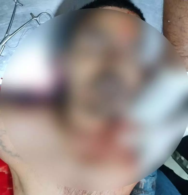 रायपुर में ई-रिक्शा चालक ने की हत्या की कोशिश, चाकू मारकर फरार रायपुर में ई-रिक्शा चालक ने की हत्या की कोशिश, चाकू मारकर फरार