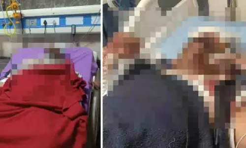 MP: राहुल गांधी की रैली से लौटते समय कार पलटी, कांग्रेस नेता घायल