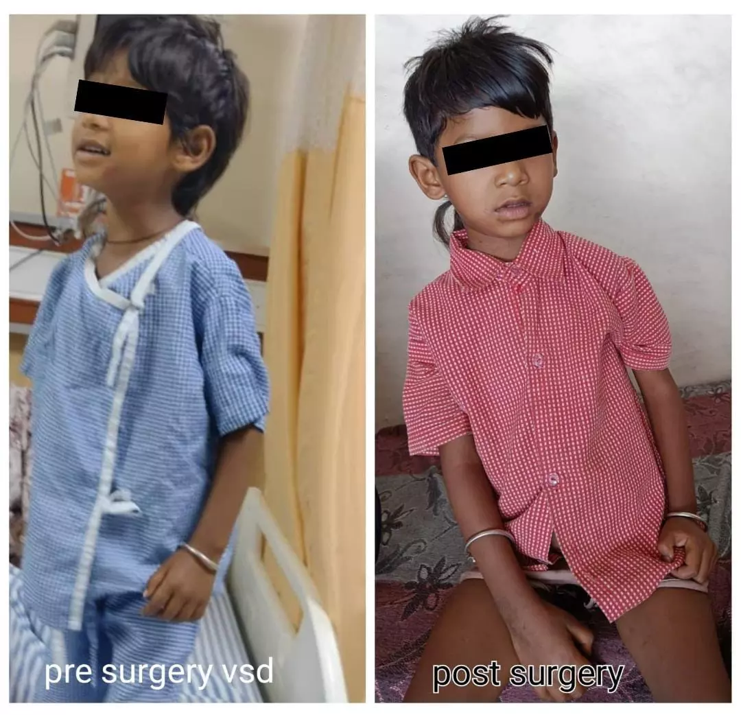 चिरायु योजना से नित्या राजवाड़े को मिला नया जीवन चिरायु योजना से नित्या राजवाड़े को मिला नया जीवन
