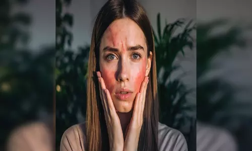 सर्द मौसम और आहार की कमी का संकेत देते हैं फटे गाल, इन उपायों से मिलेगी राहत