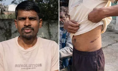 पांच साहूकार पुलिस हिरासत में, पीड़ित किसान की बाईं Kidney निकाल ली गई