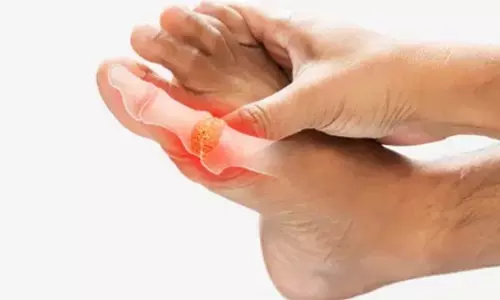 सामान्य नहीं पैर के अंगूठे और जोड़ों में अचानक होने वाला दर्द, आयुर्वेद के पास है समाधान सामान्य नहीं पैर के अंगूठे और जोड़ों में अचानक होने वाला दर्द, आयुर्वेद के पास है समाधान