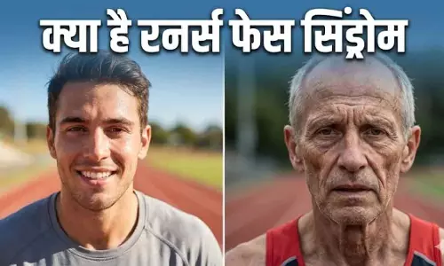 Running का साइड इफेक्ट: कहीं रनर्स फेस आपको समय से पहले बूढ़ा तो नहीं बना रहा Running का साइड इफेक्ट: कहीं रनर्स फेस आपको समय से पहले बूढ़ा तो नहीं बना रहा