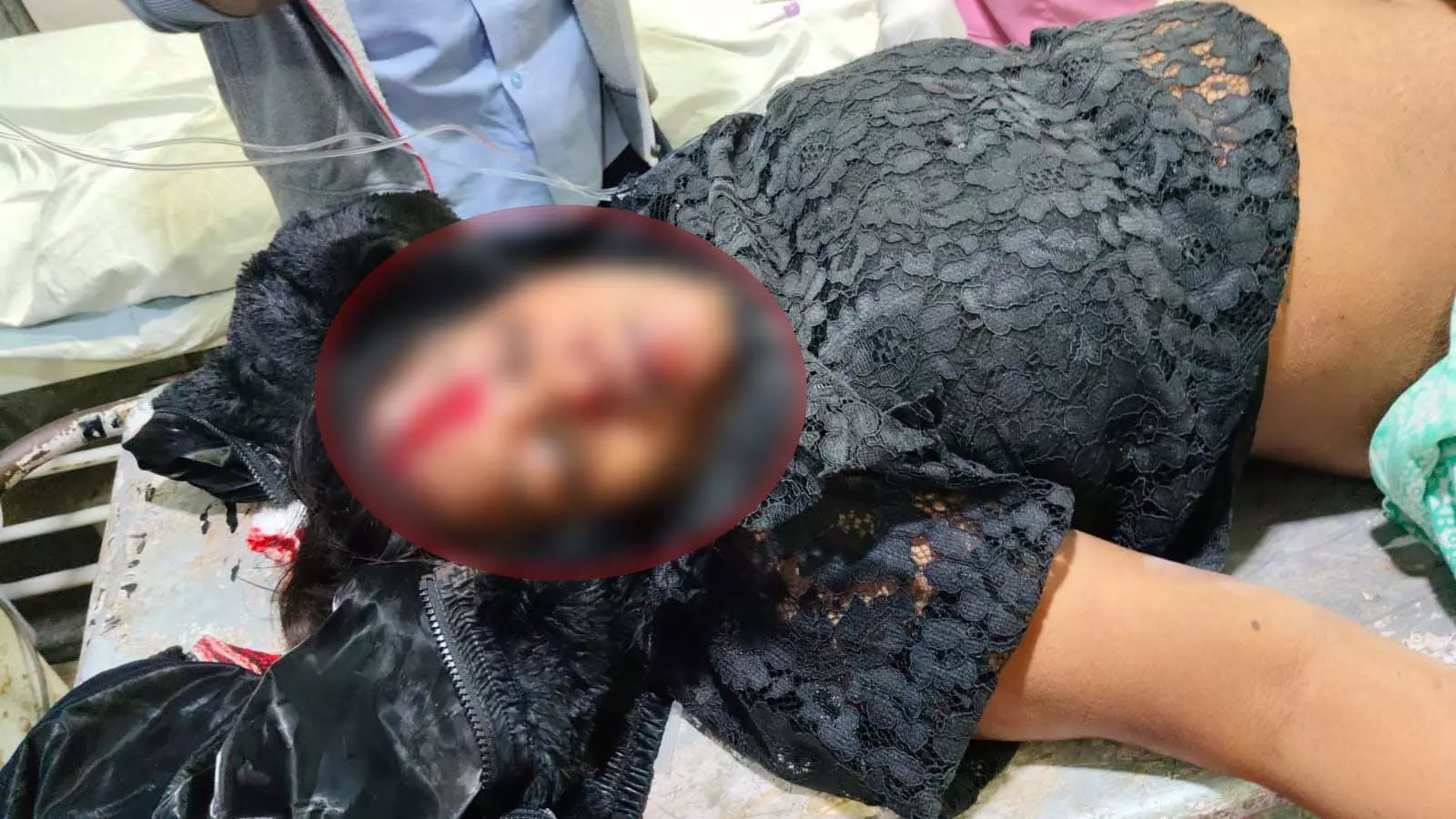 रायपुर में महिला पत्रकार को ट्रेलर ने कुचला, हालत नाजुक रायपुर में महिला पत्रकार को ट्रेलर ने कुचला, हालत नाजुक