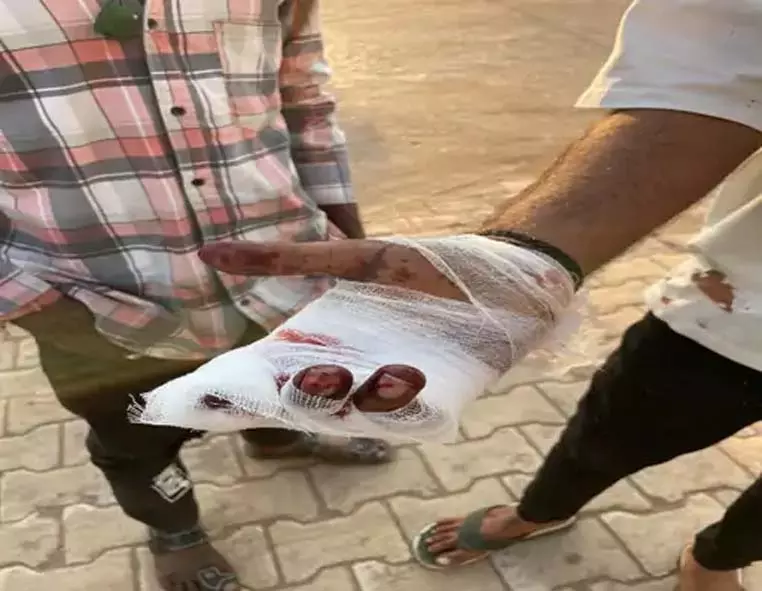 जमानत पर रिहा तीन युवकों ने FIR वापस कराने के लिए चाकू से किया हमला जमानत पर रिहा तीन युवकों ने FIR वापस कराने के लिए चाकू से किया हमला