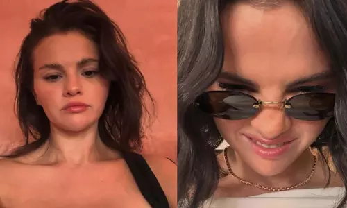 Selena Gomez ने मूंछ वाले कमेंट पर जवाब दिया, स्किन प्रॉब्लम के बारे में बात की