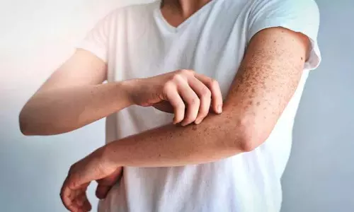 Skin Itching? राहत के लिए ये घरेलू उपाय आज़माएँ। Skin Itching? राहत के लिए ये घरेलू उपाय आज़माएँ।