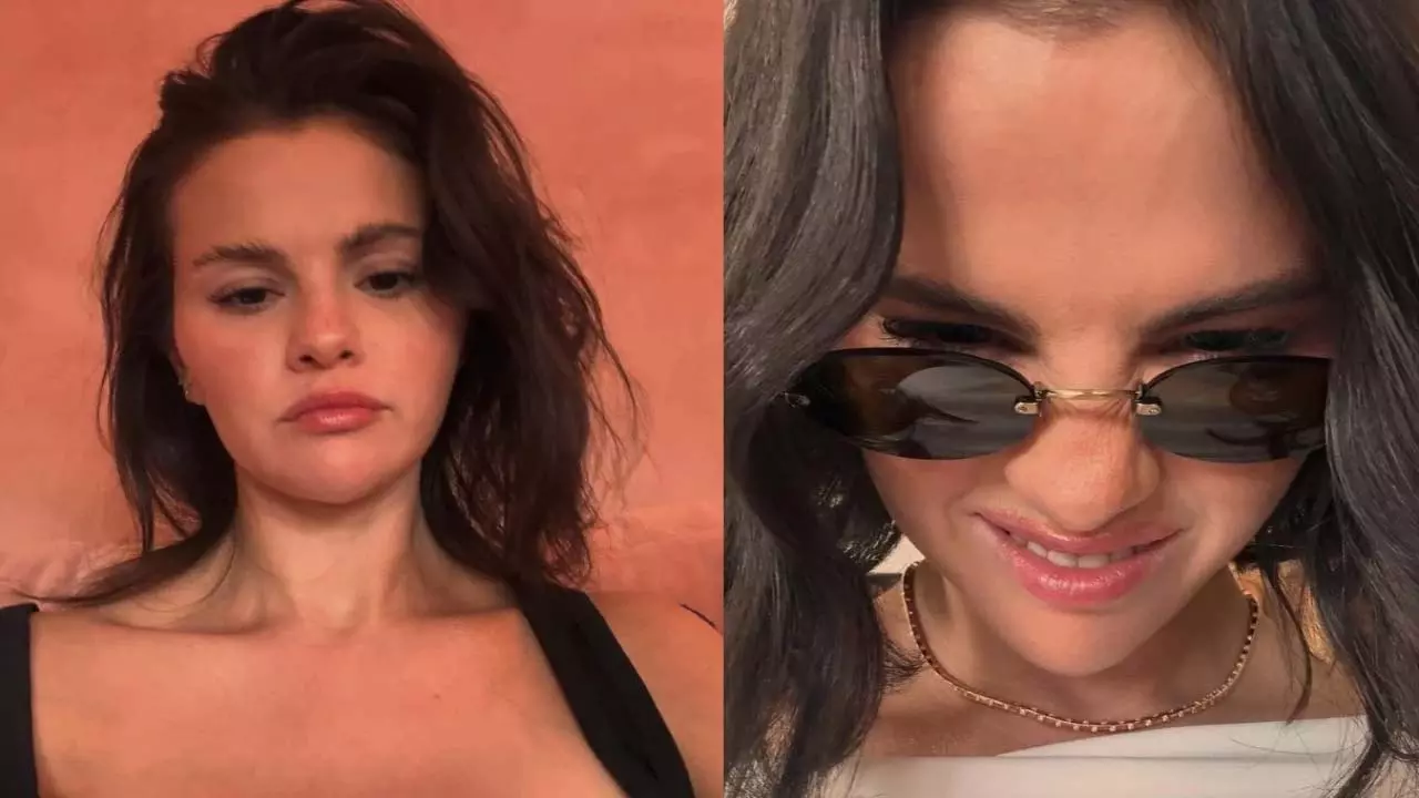 Selena Gomez ने मूंछ वाले कमेंट पर जवाब दिया, स्किन प्रॉब्लम के बारे में बात की Selena Gomez ने मूंछ वाले कमेंट पर जवाब दिया, स्किन प्रॉब्लम के बारे में बात की