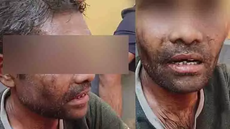 Kerala: चोरी के झूठे आरोप में प्रवासी मजदूर की हत्या Kerala: चोरी के झूठे आरोप में प्रवासी मजदूर की हत्या