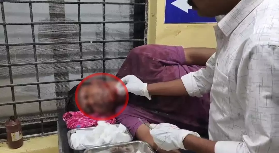 DSP पर जानलेवा हमला: डॉक्टर की पत्नी और परिचित युवक ने चाकू से किया वार DSP पर जानलेवा हमला: डॉक्टर की पत्नी और परिचित युवक ने चाकू से किया वार