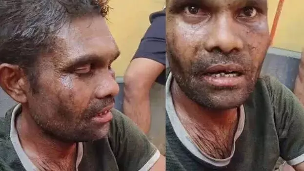 kerala: छत्तीसगढ़ के व्यक्ति पर वालयार में हिंसक हमला, मॉब लिंचिंग के नए तथ्य kerala: छत्तीसगढ़ के व्यक्ति पर वालयार में हिंसक हमला, मॉब लिंचिंग के नए तथ्य