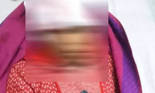 खेल रही बच्ची को आवारा कुत्ते ने नोचा, हालत गंभीर खेल रही बच्ची को आवारा कुत्ते ने नोचा, हालत गंभीर