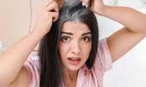 कम उम्र में Hair सफेद होना, कारण और रोकथाम