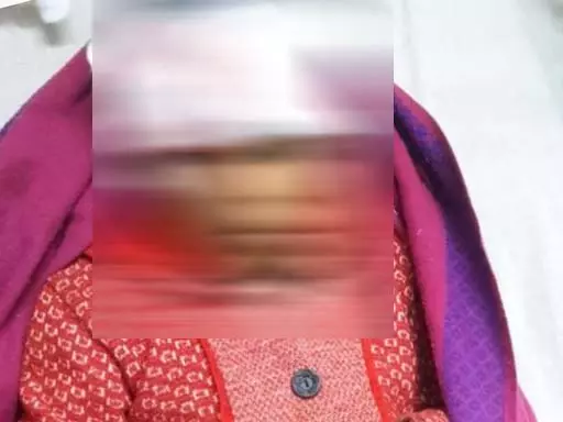 खेल रही बच्ची को आवारा कुत्ते ने नोचा, हालत गंभीर खेल रही बच्ची को आवारा कुत्ते ने नोचा, हालत गंभीर