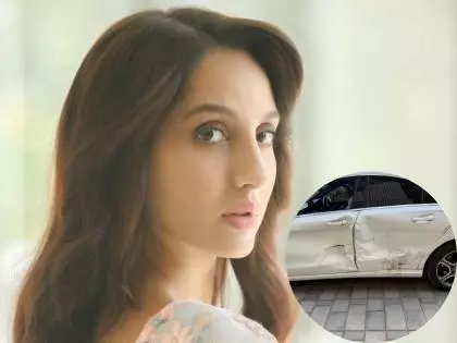 Nora Fatehi की कार को शराबी ड्राइवर ने टक्कर मारी, सिर में लगी चोट Nora Fatehi की कार को शराबी ड्राइवर ने टक्कर मारी, सिर में लगी चोट