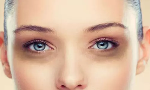 Dark Circles: इन्हें हटाने के लिए इन प्राकृतिक घरेलू उपायों को अपनाएं