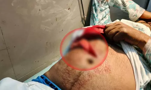 CG BREAKING: विवाह समारोह के दौरान चाकूबाजी, भाई ने भाई पर किया हमला CG BREAKING: विवाह समारोह के दौरान चाकूबाजी, भाई ने भाई पर किया हमला