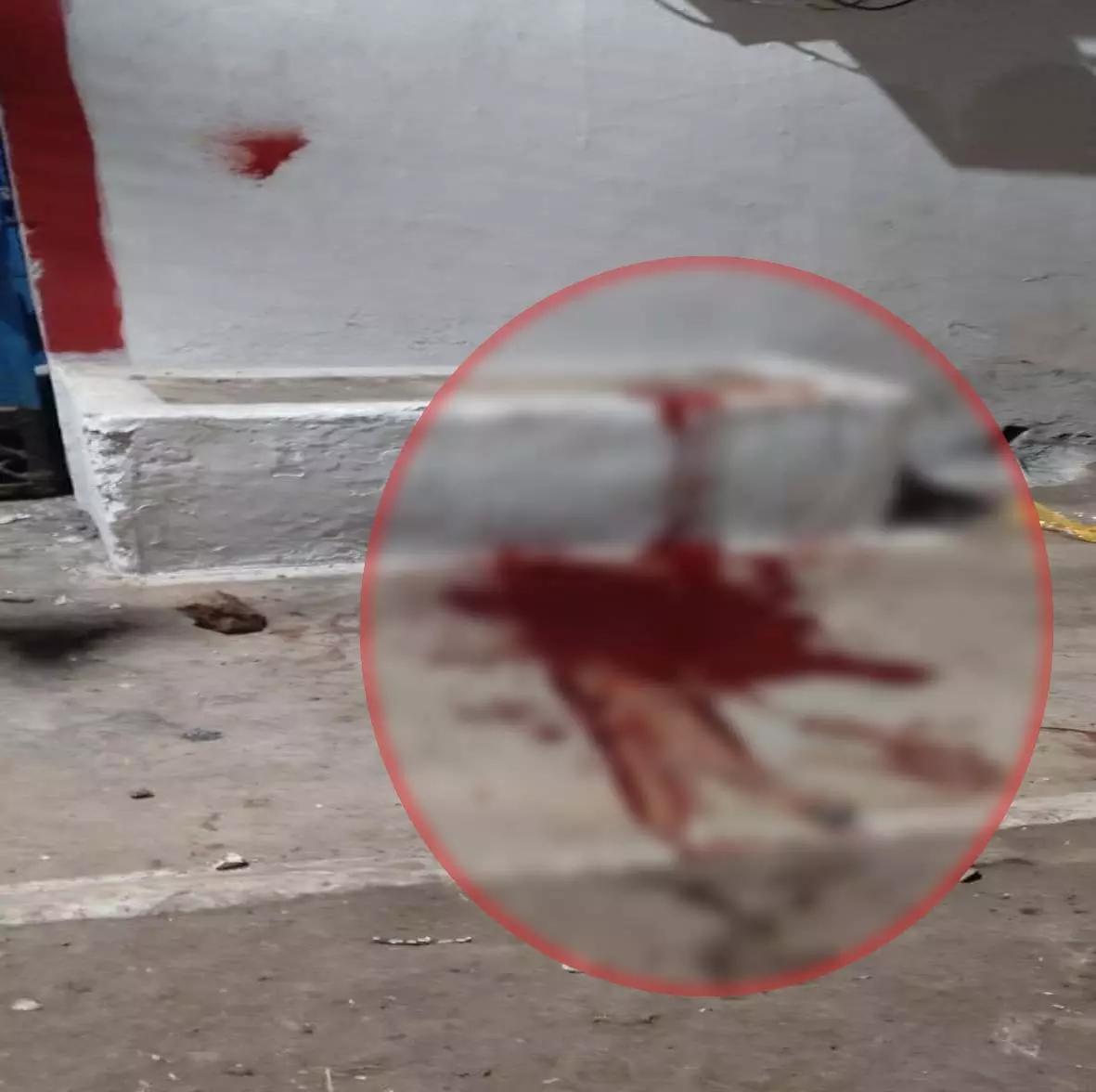 जयन्ती नाचा कार्यक्रम की खुशियां मातम में बदली, युवक पर हुआ चाकू से हमला जयन्ती नाचा कार्यक्रम की खुशियां मातम में बदली, युवक पर हुआ चाकू से हमला