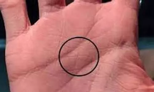 Palmistry Cross Sign: हथेली पर रहस्यमयी क्रॉस और धन से इसका गुप्त रहस्य Palmistry Cross Sign: हथेली पर रहस्यमयी क्रॉस और धन से इसका गुप्त रहस्य