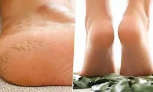 Foot Care in Winter: ठंड के मौसम में फट रही हैं एड़ियां, तो आजमाइए तो ये नुस्खे Foot Care in Winter: ठंड के मौसम में फट रही हैं एड़ियां, तो आजमाइए तो ये नुस्खे