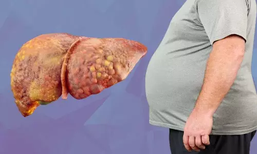 Fatty Liver के लक्षण: स्वास्थ्य समस्याओं से बचने के लिए इन पर ध्यान देना ज़रूरी Fatty Liver के लक्षण: स्वास्थ्य समस्याओं से बचने के लिए इन पर ध्यान देना ज़रूरी