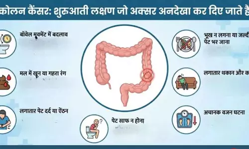 कोलन Cancer के शुरुआती संकेत: समय पर पहचानें, जान बचाएं कोलन Cancer के शुरुआती संकेत: समय पर पहचानें, जान बचाएं