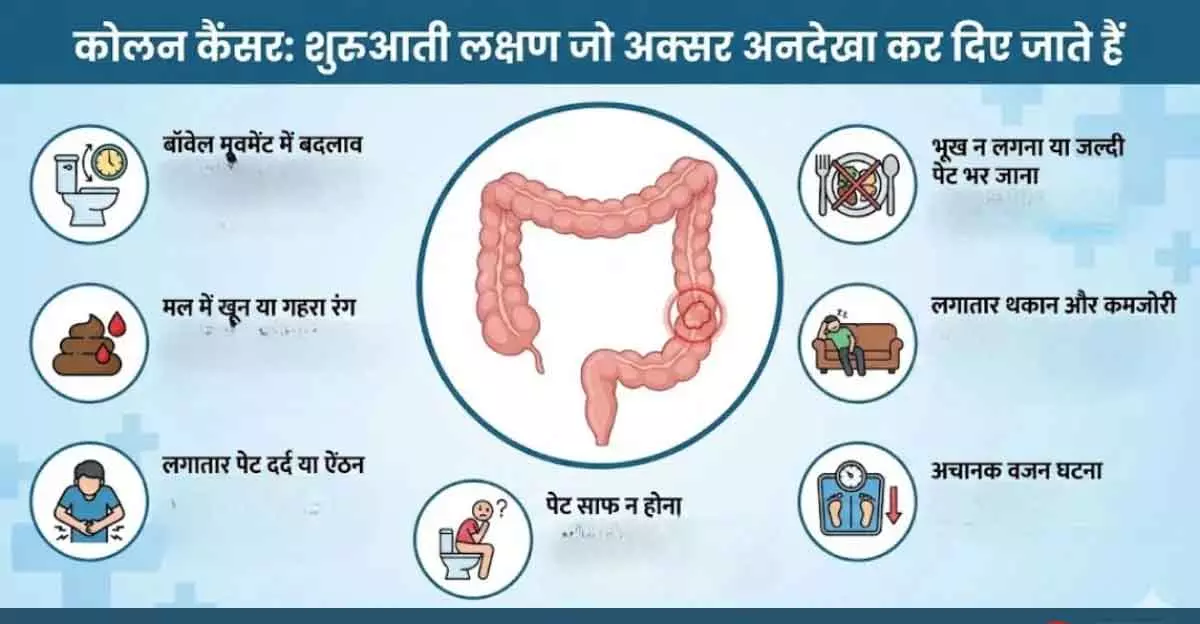कोलन Cancer के शुरुआती संकेत: समय पर पहचानें, जान बचाएं कोलन Cancer के शुरुआती संकेत: समय पर पहचानें, जान बचाएं