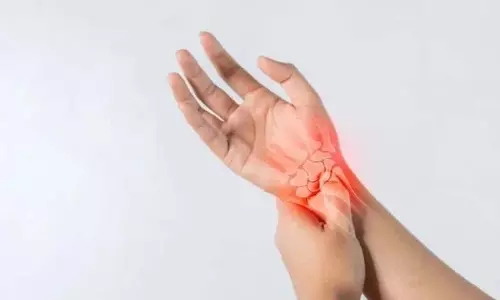 गठिया के लक्षण अगर आपको ये लक्षण दिखें तो Doctor से ज़रूर सलाह लें गठिया के लक्षण अगर आपको ये लक्षण दिखें तो Doctor से ज़रूर सलाह लें