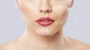 How to Remove Acne Scars: चेहरे के गड्ढे कर रहे हैं परेशान, इन आसान उपायों से पाएं बेदाग निखार How to Remove Acne Scars: चेहरे के गड्ढे कर रहे हैं परेशान, इन आसान उपायों से पाएं बेदाग निखार