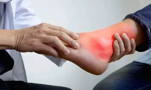 अगर आप ये फूड्स ले रहे हैं तो आपका Uric Acid लेवल बढ़ जाएगा अगर आप ये फूड्स ले रहे हैं तो आपका Uric Acid लेवल बढ़ जाएगा