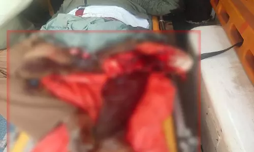 नए साल के पहले दिन रायपुर में रफ्तार का कहर, ई-रिक्शा चालक का पैर कटा
