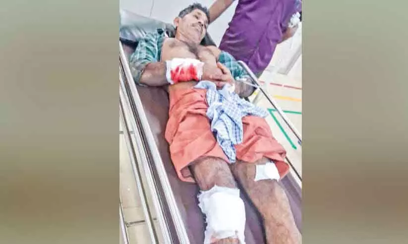 Kerala : जंगली सूअर के हमले में नारियल बागान का कर्मचारी गंभीर रूप से घायल Kerala : जंगली सूअर के हमले में नारियल बागान का कर्मचारी गंभीर रूप से घायल