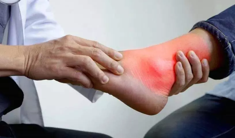 अगर आपका Uric Acid लेवल ज़्यादा है तो ये चीज़ें खाएं अगर आपका Uric Acid लेवल ज़्यादा है तो ये चीज़ें खाएं