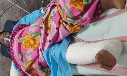 शिकारियों के तार के जाल के संपर्क में आने से गजमित्र की हालत गंभीर शिकारियों के तार के जाल के संपर्क में आने से गजमित्र की हालत गंभीर