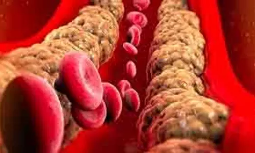 Cholesterol : डरना नहीं, समझकर नियंत्रण करना जरूरी