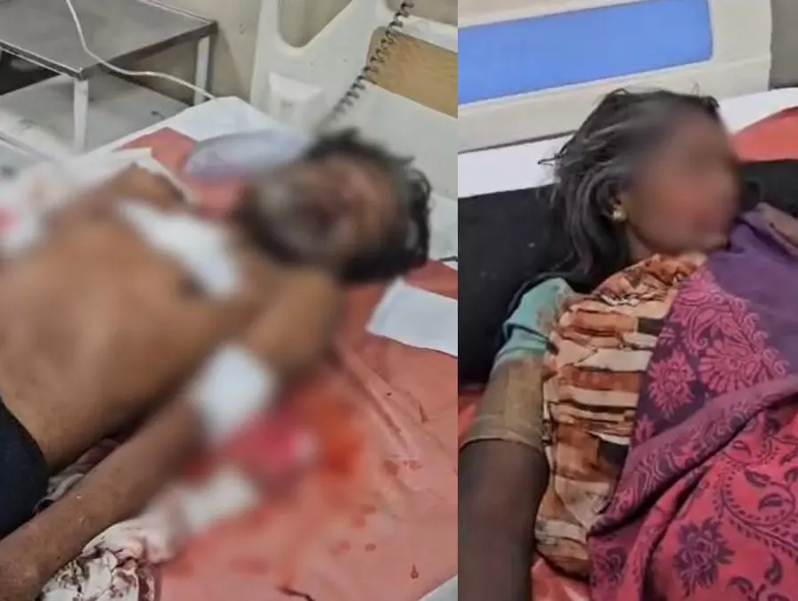 CG: पति ने पत्नी पर चाकू से किया हमला, दोनों गंभीर रूप से घायल CG: पति ने पत्नी पर चाकू से किया हमला, दोनों गंभीर रूप से घायल