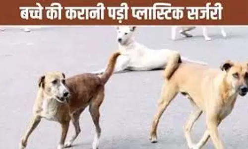 Rajasthan :आवारा कुत्तों का आतंक, मासूम पर जानलेवा हमला